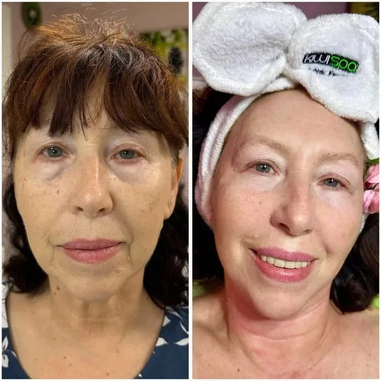 Before and after: tone and clarity