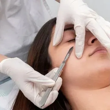Dermaplaning
