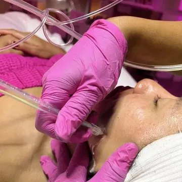 JetPeel during the professional facial