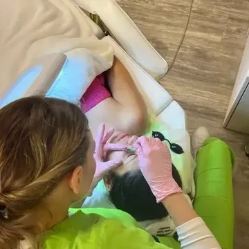 Diamond tip microdermabrasion