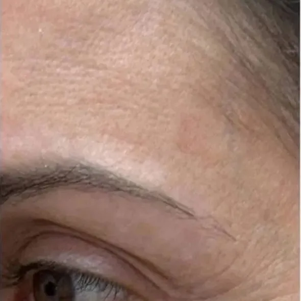 Skin showing fine lines and firmness